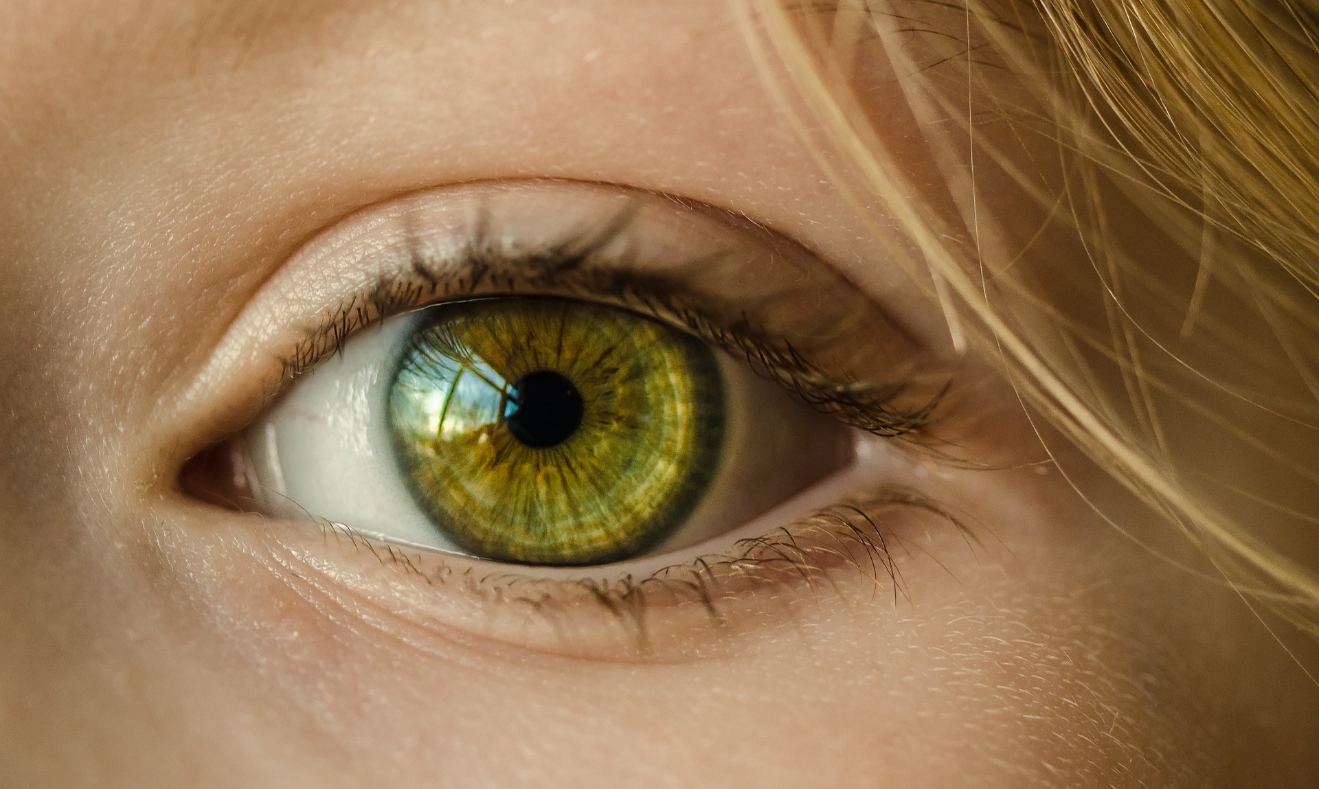 Konjunktivitis