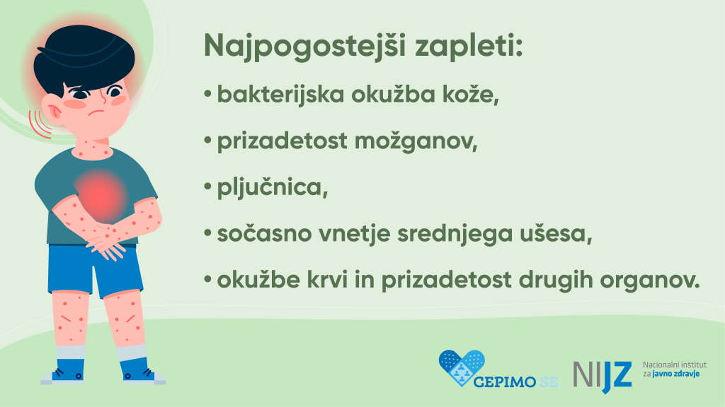 Najpogostejši zapleti noric so bakterijska okužba kože, prizadetost možganov, pljučnica, sočasno vnetje srenjega ušesa, okužbe krvi in prizadetost drugih organov.